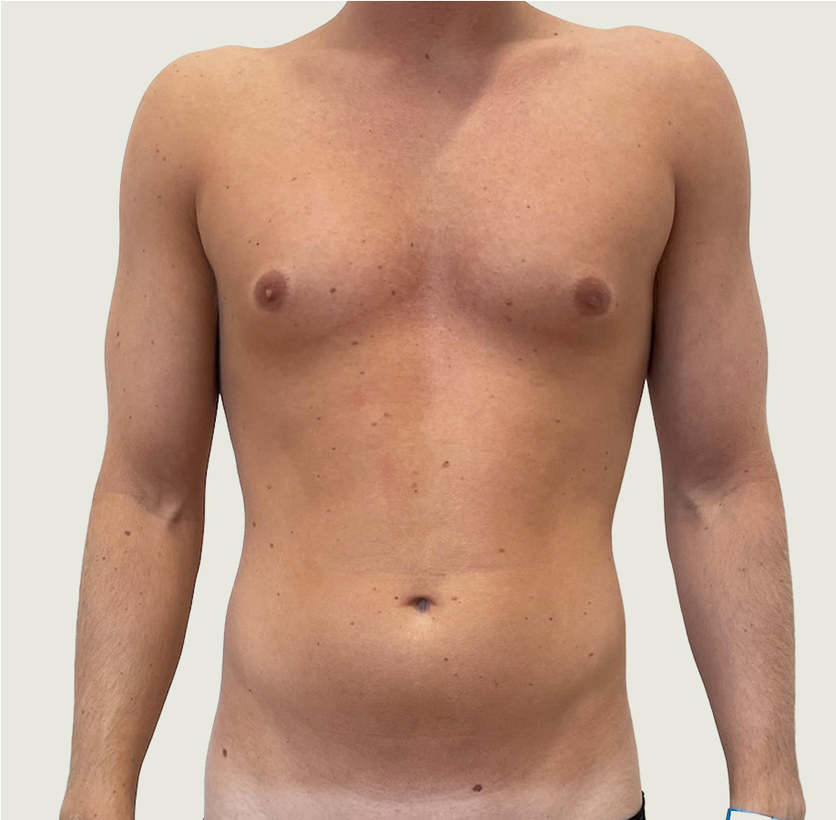 BodyConturing men before