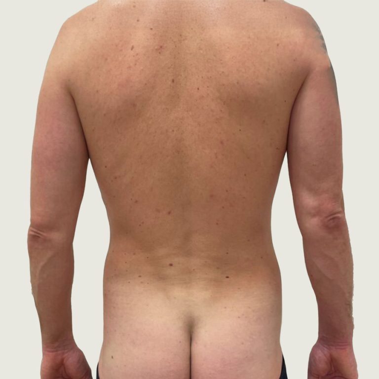 After man body conturing from back