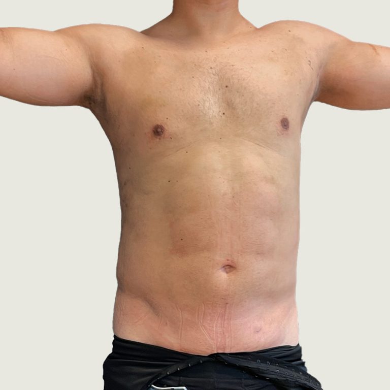 After man body conturing