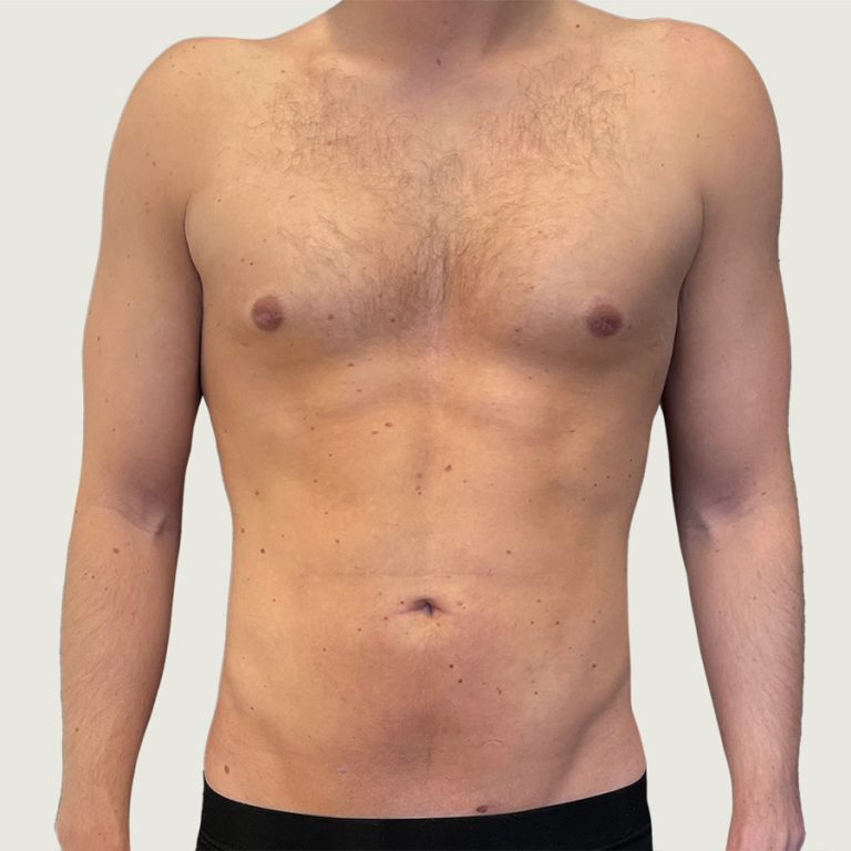 Before man body conturing