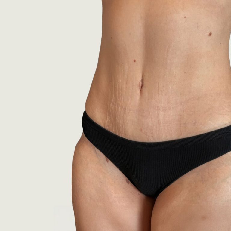 After BodyConturing high def