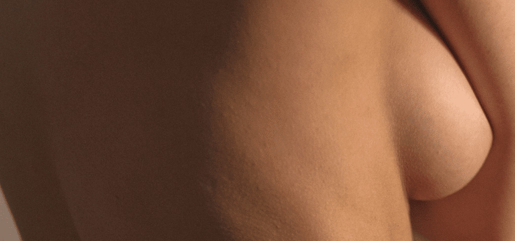 Plastikirurgi Sculpture by