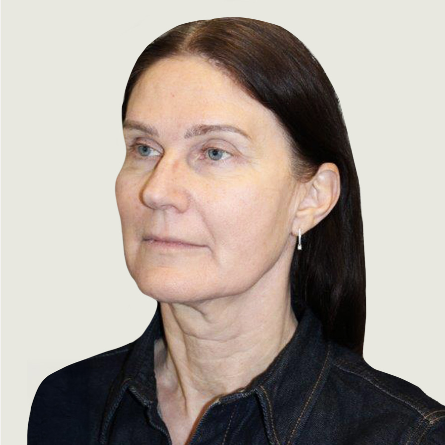 Deep plane necklift før